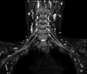 image-3D-NerveVIEW